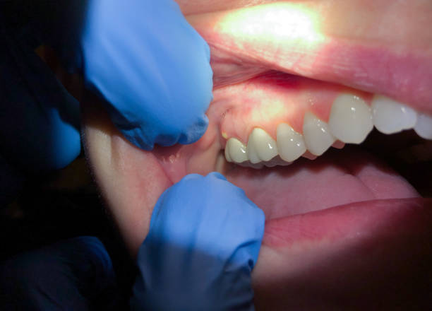 Best Pediatric Emergency Dentist in Glenn Dale, MD